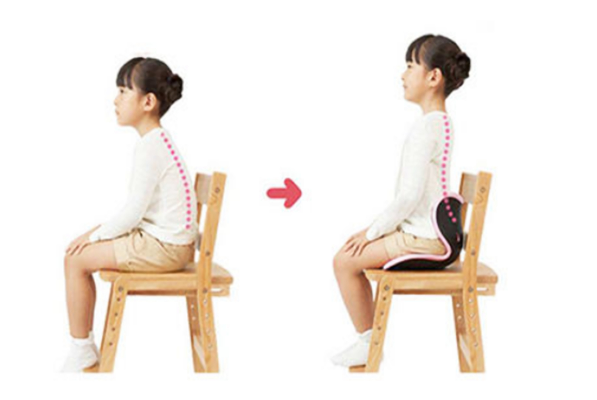 孩子驼背适合练什么,孩子驼背矫正有用吗