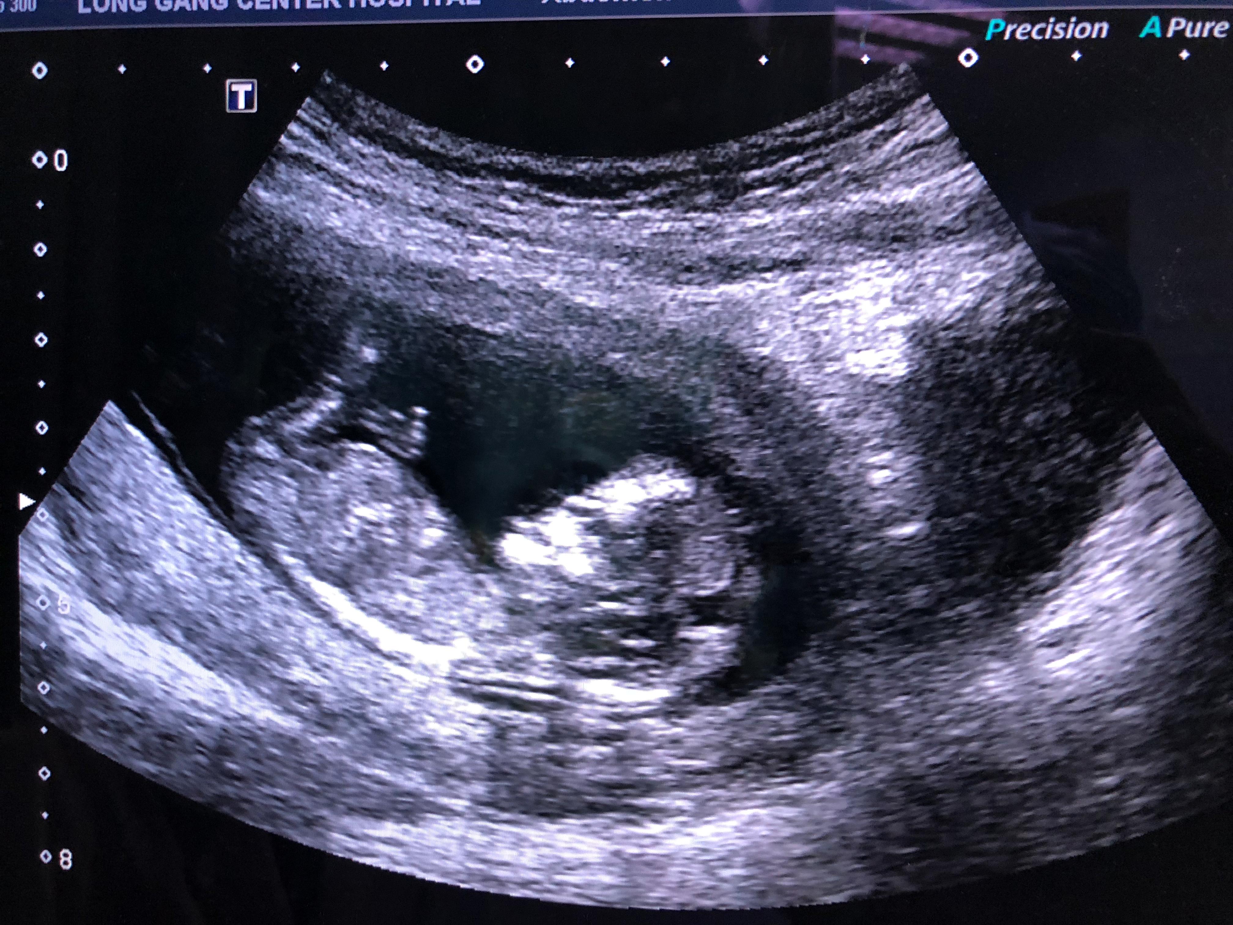 医生科普孕产妇避坑指南,经验分享孕妈们必看