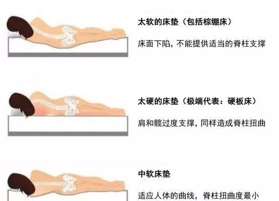 睡硬板床真能拯救你的腰吗,睡硬板床能治腰突么