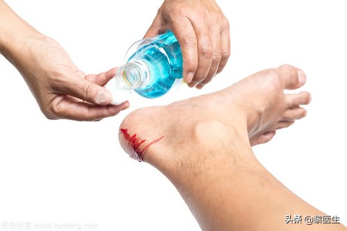 伤口感染，长期换药无效该怎么办？