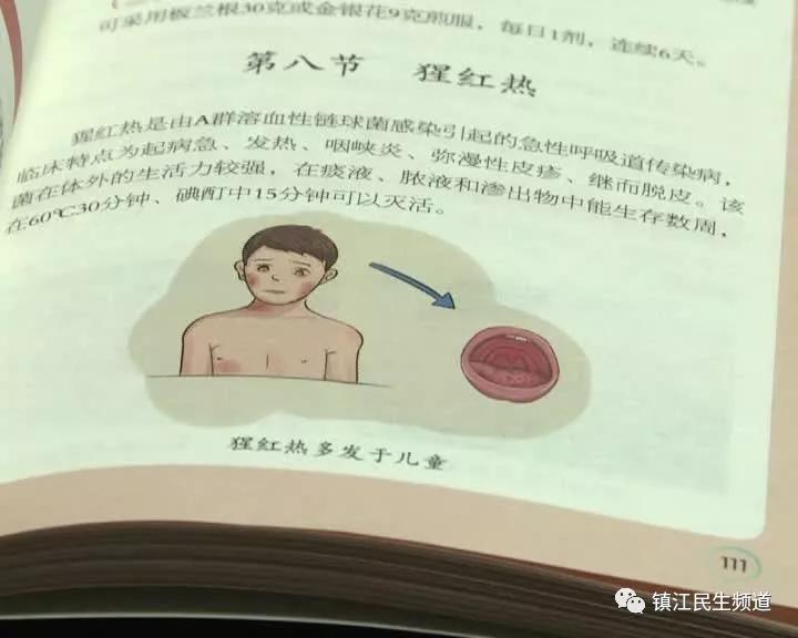 这种传染病进入发病高峰，名字有点吓人，还会交叉感染