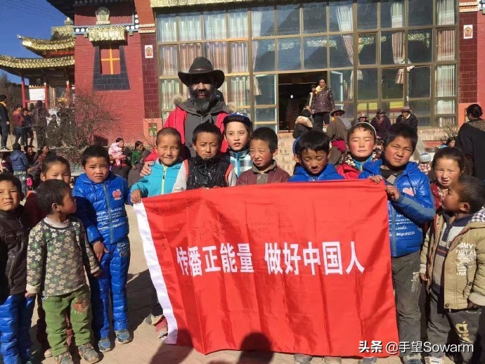 全世界体毛最多的人，是如何在歧视中逆袭为实力派歌手的？