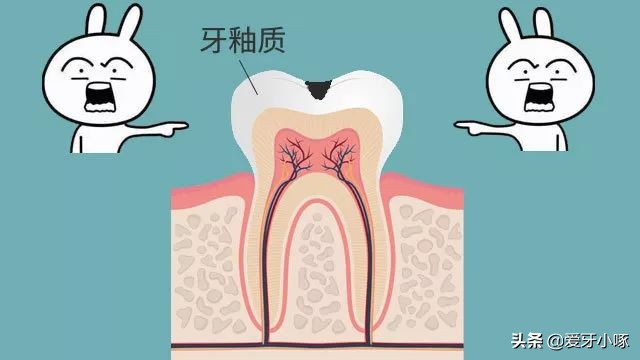 牙齿缺了一小块疼痛怎么办,牙齿缺了一块很疼怎么补救