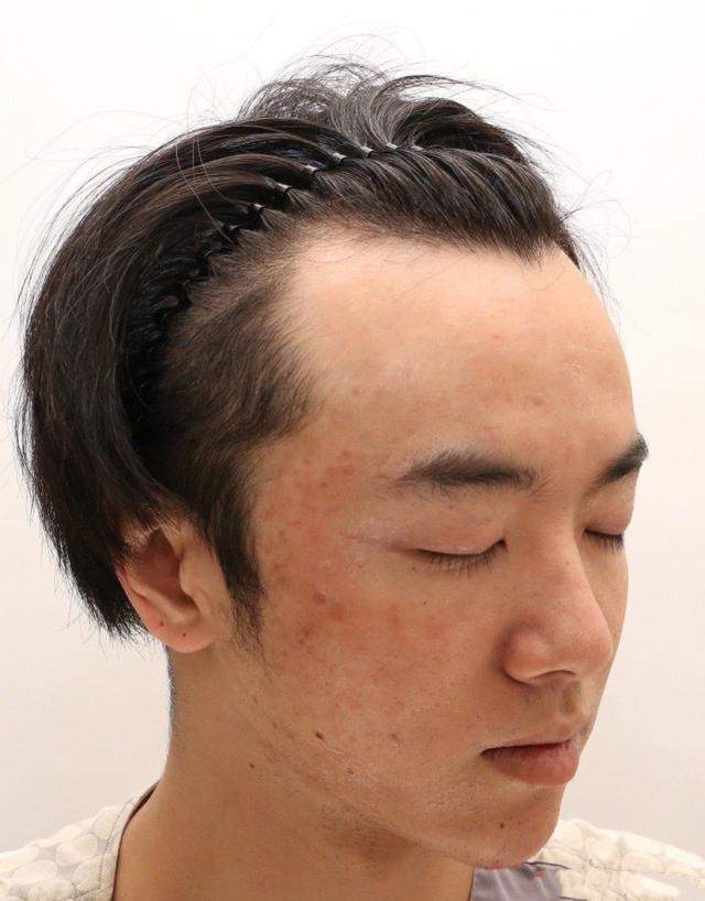 网友：张碧晨插足成小三？华晨宇“实锤”整容“？律师起诉？