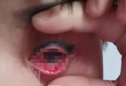 美容店毁容女孩,美容店的毁容事件