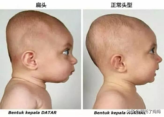 宝宝偏头睡觉怎么纠正最有效,一岁宝宝偏头睡觉如何矫正