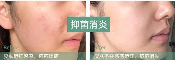 张韶涵护肤全部产品,张韶涵海蓝之谜