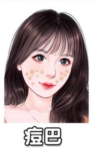 不要“月球脸”，6种痘印去除指南，养成光滑水嫩“牛奶肌”