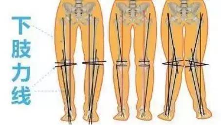 娃儿喊脚酸是什么情况,小孩子说脚痛和肚子痛是什么病