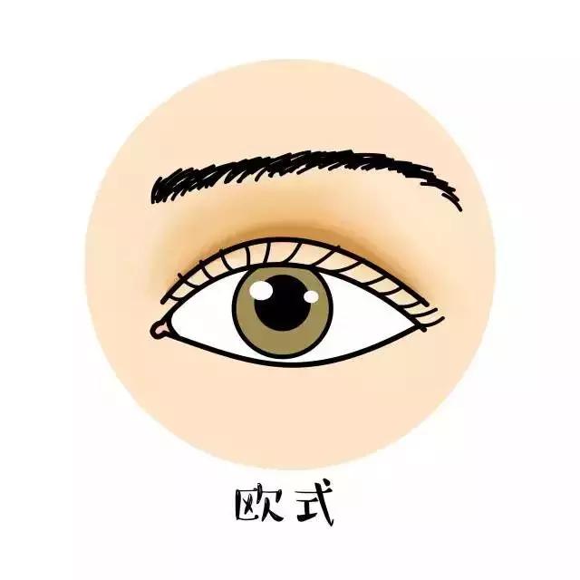 欧式大平行双眼皮什么意思,欧式双眼皮适合什么样的人割