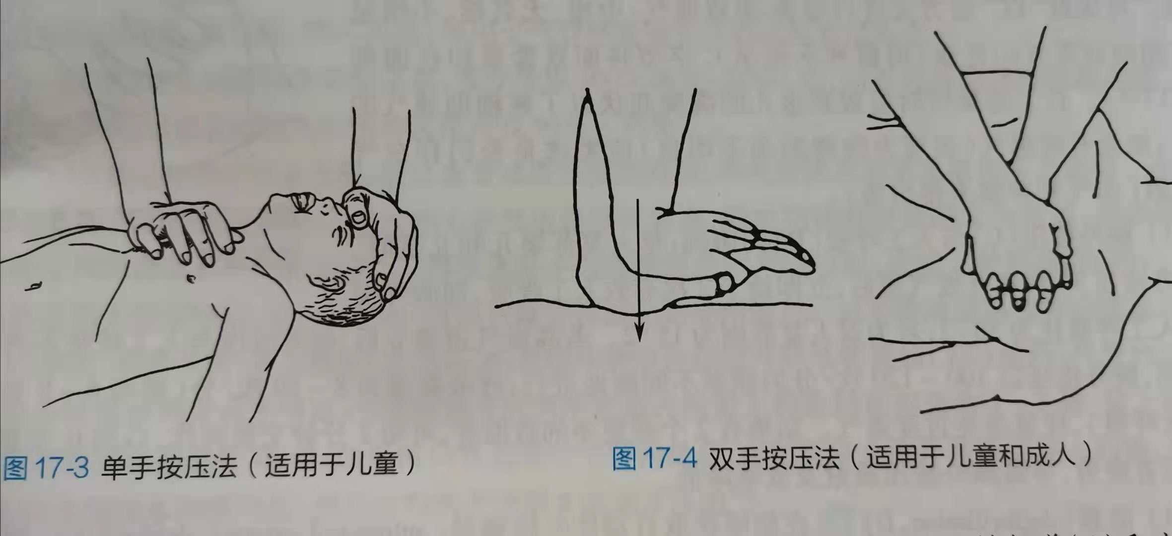 盘江总医院：家长们注意了！藏在幼儿衣物里的“隐形杀手”不容忽视