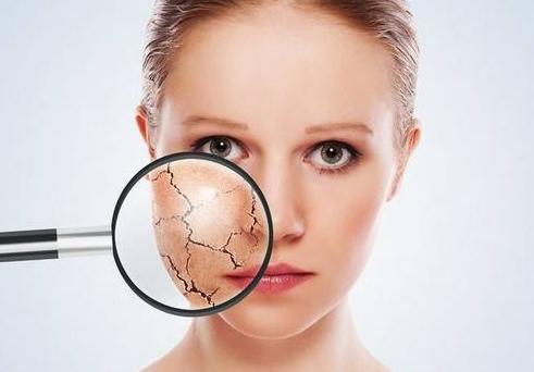 敷面膜补水最快的方法,脸部皮肤缺水干燥痒可以敷面膜吗