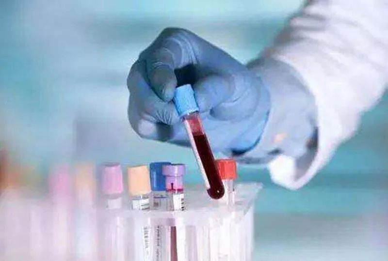 癌胚抗原升高，一定是患癌了吗？升高多少与病情严重程度有关系吗