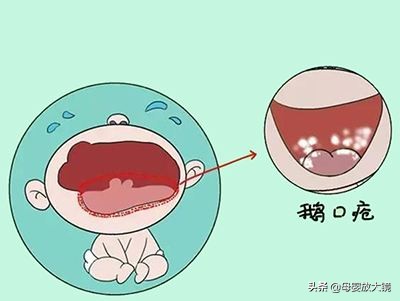 5月龄宝宝怎么培养自己玩,5-6月龄宝宝如何喂养