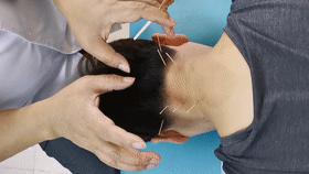 神经根型颈椎病针灸推拿能治愈吗,椎动脉型颈椎病怎么推拿针灸