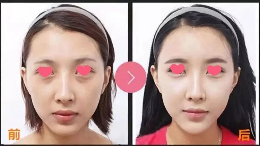 脸干的起皮敷面膜不管用怎么办,脸太干可以天天敷面膜吗