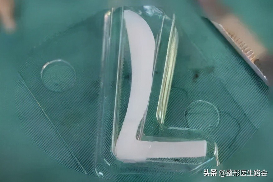 硅胶隆鼻会破坏原来的鼻子吗,隆鼻硅胶可以永久不取吗