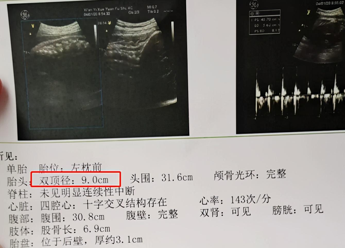 胎宝宝大小和手的比较,胎宝宝发育过程头的位置变化