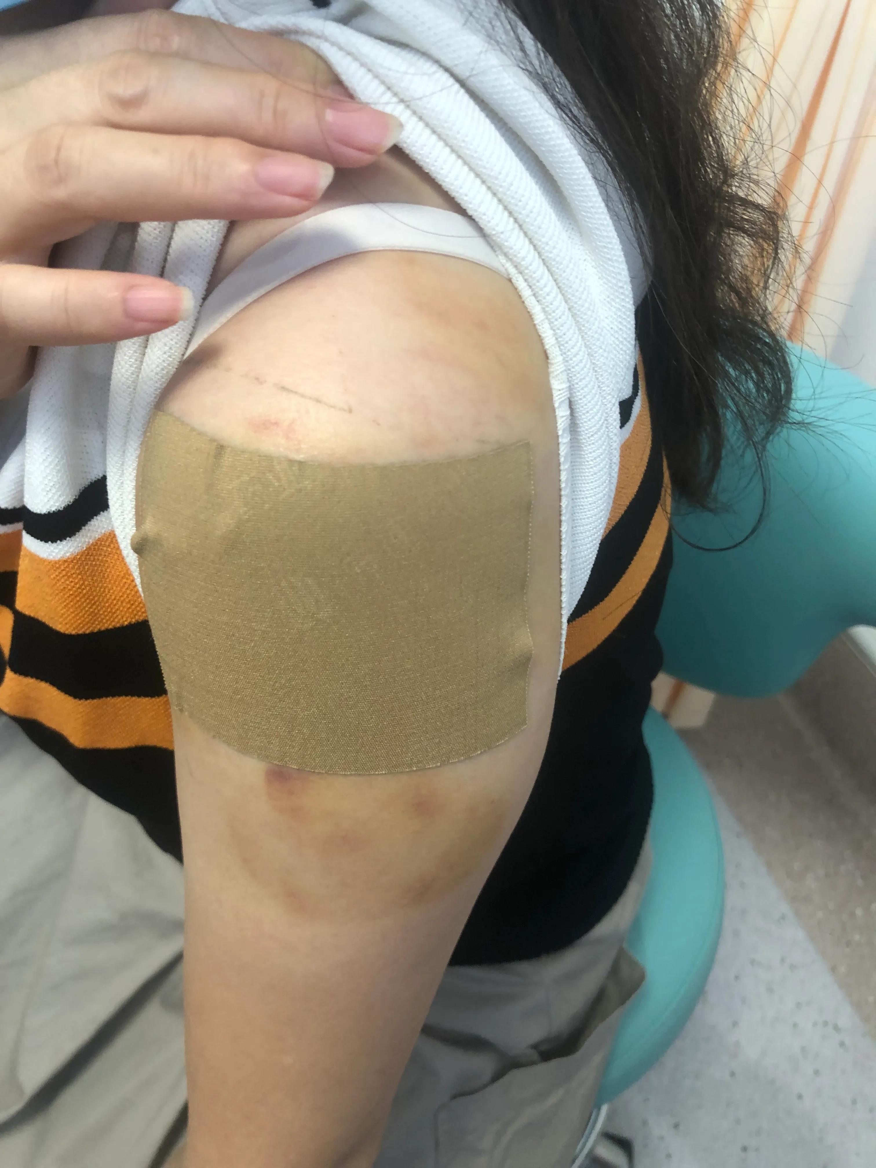 贴药膏过敏了过一个星期能治好吗,贴膏药过敏了怎么办最快方法