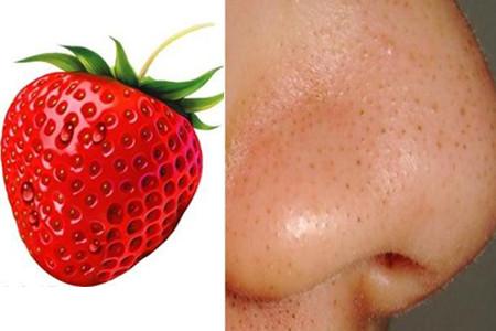 怎么才能有效的去除草莓鼻,消除草莓鼻的最快方法不用化妆