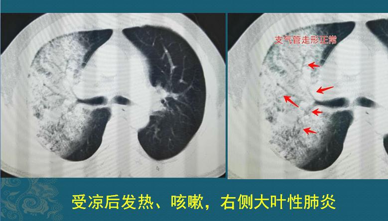 上帝造人时给我们造的东西,上帝在造人时给人装了两个口袋