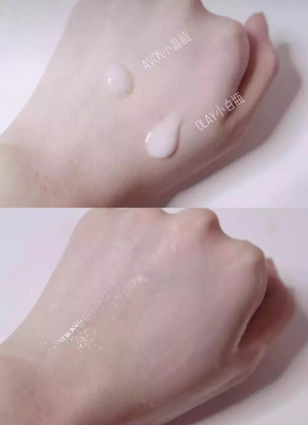 欧阳娜娜擦什么药膏好,欧阳娜娜安利祛疤膏