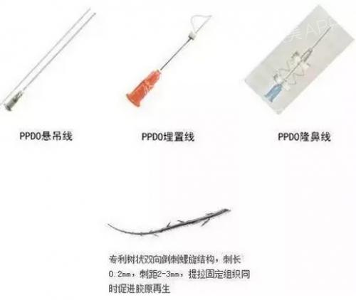 42岁做拉皮还是线雕,做线雕一年后可以做拉皮术吗