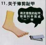 糖尿病足负压护理及观察要点,糖尿病足居家护理