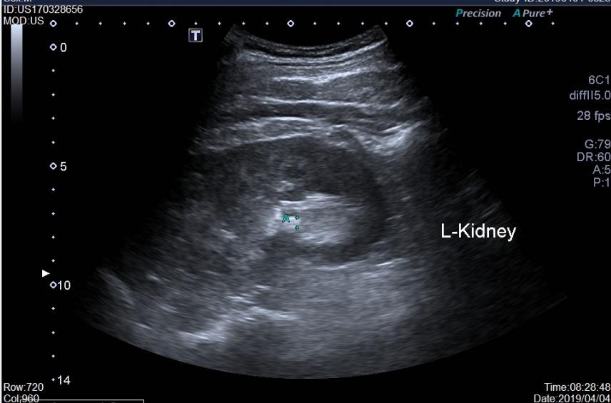 尿常规结果报告软件,尿常规报告细菌