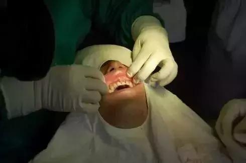 有人拔牙收100块，有人却收1000块！