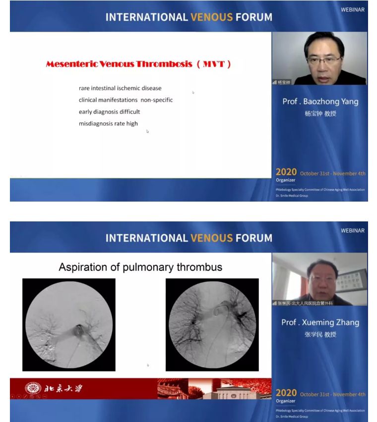 开幕第一天精彩回顾｜2020国际静脉病论坛持续进行中