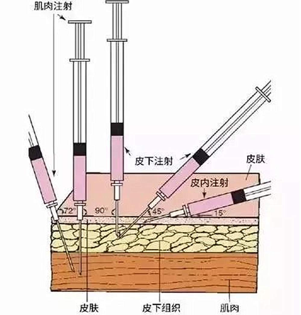 自己给成年猫咪打疫苗的正确方法,铲屎官可以自己给猫咪打疫苗吗
