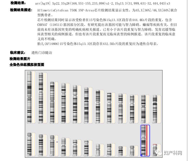胎儿染色体检查出特纳综合征,孕妇特纳综合征的症状