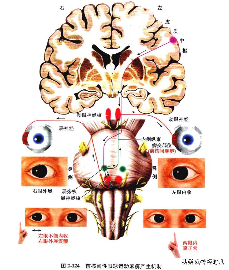 脑干解剖,脑干神经解剖