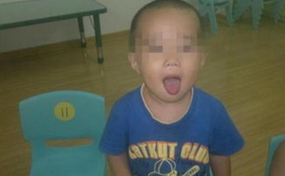 孩子说话结巴有效解决方法,孩子说话结巴如何纠正视频