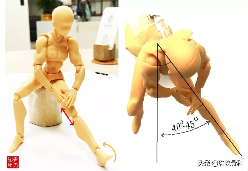 鹅足肌腱炎是不是膝关节炎,不明原因脚筋痛