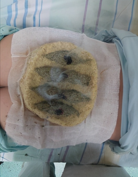 小儿尿床预防方法,小儿尿床有没有好药方