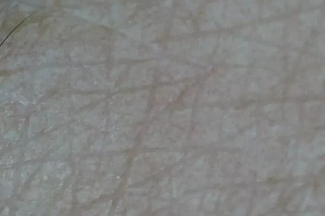 杨紫近照曝光无修图法令纹很深,杨紫面部填充法令纹