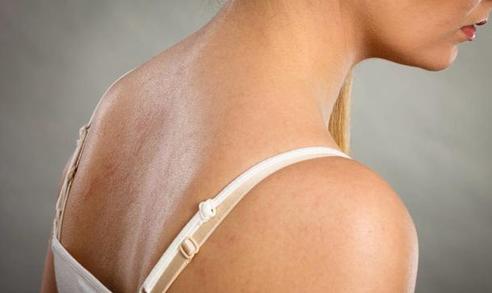 冬季皮肤干燥发痒用硫磺皂可以吗,上海硫磺皂洗皮肤有什么功效