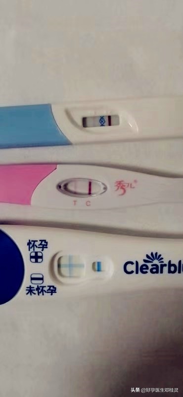 假孕争宠真实案例,假孕争宠是大忌