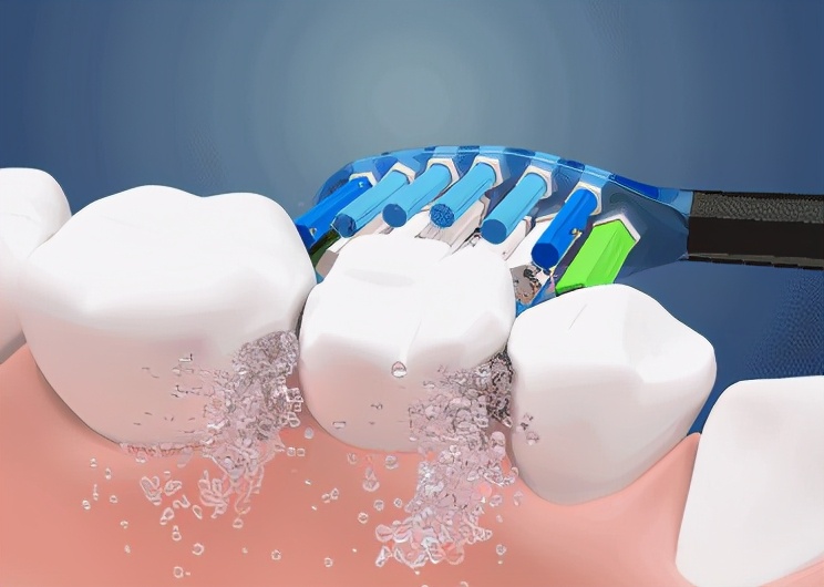 牙齿太黄刷牙总是刷不干净怎么办,天天刷牙还是牙黄口臭是怎么回事