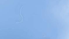 眼前一直有蚊子是什么病,眼前总有蚊子飞怎么治呀