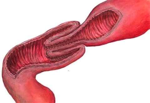 宝宝得了鹅口疮怎么解决,宝宝得了鹅口疮要怎么治疗