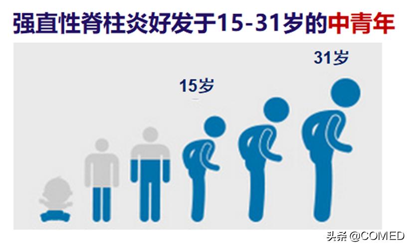 北京协和医院类风湿专家曾小峰,免疫科专家协和曾小峰