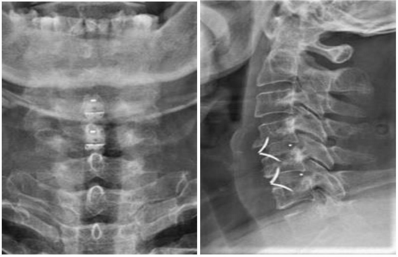 张忠根教授授课简介,李春根发改委