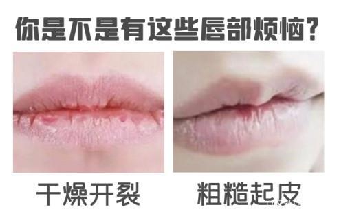 变色唇膏什么牌子的比较好用,唇炎用什么唇膏比较好