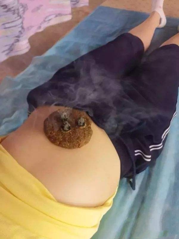 把穴位像药物一样分类后,运用竟如此简单