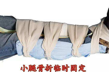 严重创伤骨折现场急救的重要性,儿童骨折如何进行现场处理