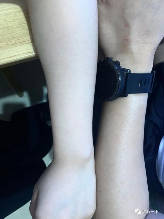 黄黑皮美白全攻略,黑黄皮身体防晒美白