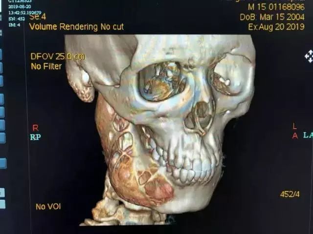 多大年龄出现牙痛,小小年纪就有牙痛怎么办